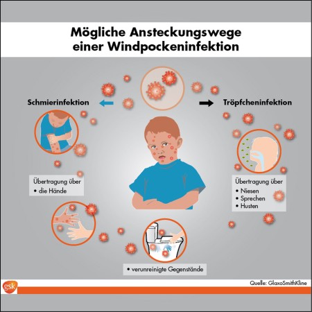 Windpocken - Mögliche Ansteckungswege - Infografik (Grafik © GSK)