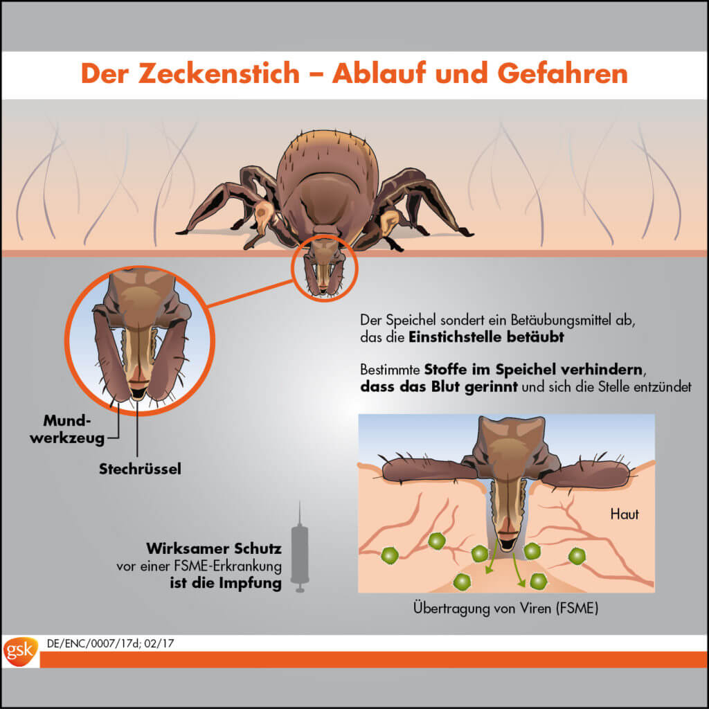 Der Zeckenstich (Grafik © GSK)