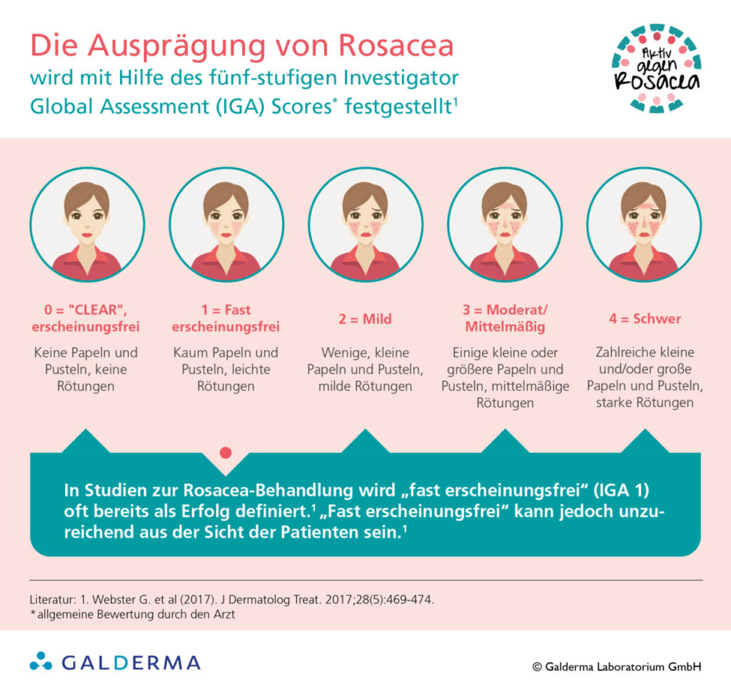 Die Ausprägung von Rosacea - Infografik